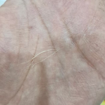 Ruffles Cipsinde Bulunan Yabancı İplik Sağlık Endişesi Ve Güveni Sarsıyor