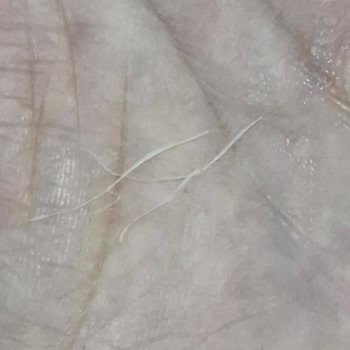 Ruffles Cipsinde Bulunan Yabancı İplik Sağlık Endişesi Ve Güveni Sarsıyor