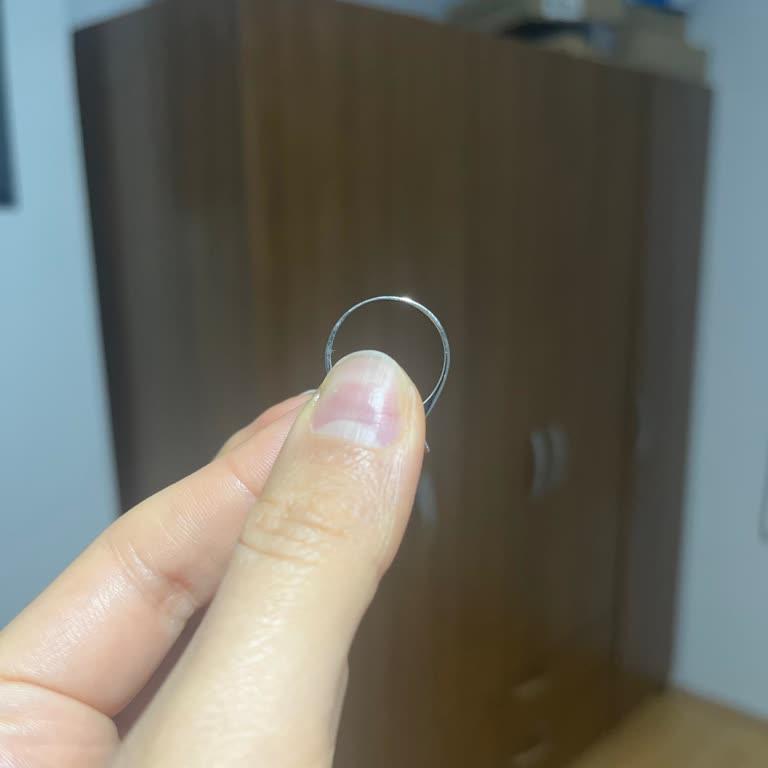 Atasay’da Yüzük Tamirinde Tekrarlanan Özensiz Ve Orantısız Kaynak