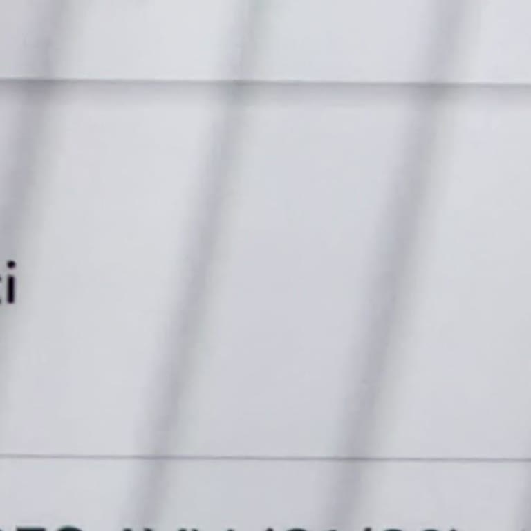 Akbank Axess Kredi Kartındaki İzinsiz 1.504,50 TL Aidat Kesintisi İadesi Talebi