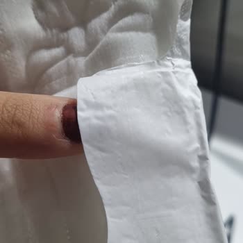 Molped Pedlerde Yapışkan Hatası Nedeniyle Hijyen Riski Ve Kullanılamaz Ürün