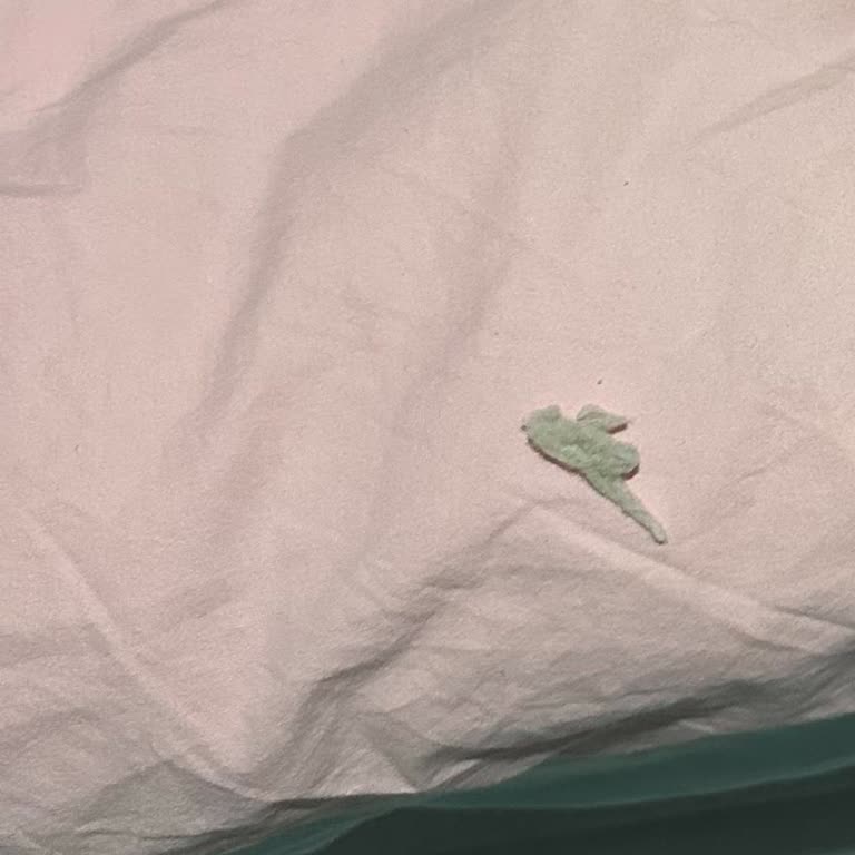 Tudors Online Pijama Takımlarında Şiddetli Tüylenme Ve Pamuk Bırakma Sorunu