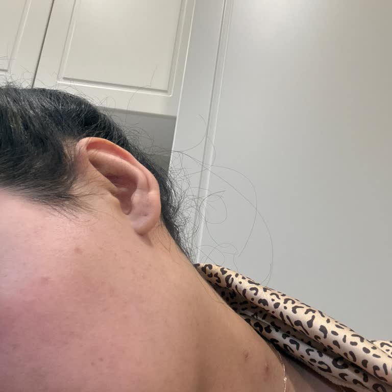 Cream Co Yüz Temizleme Jeli Cildimde Şiddetli Döküntü Ve Akne Oluşturdu