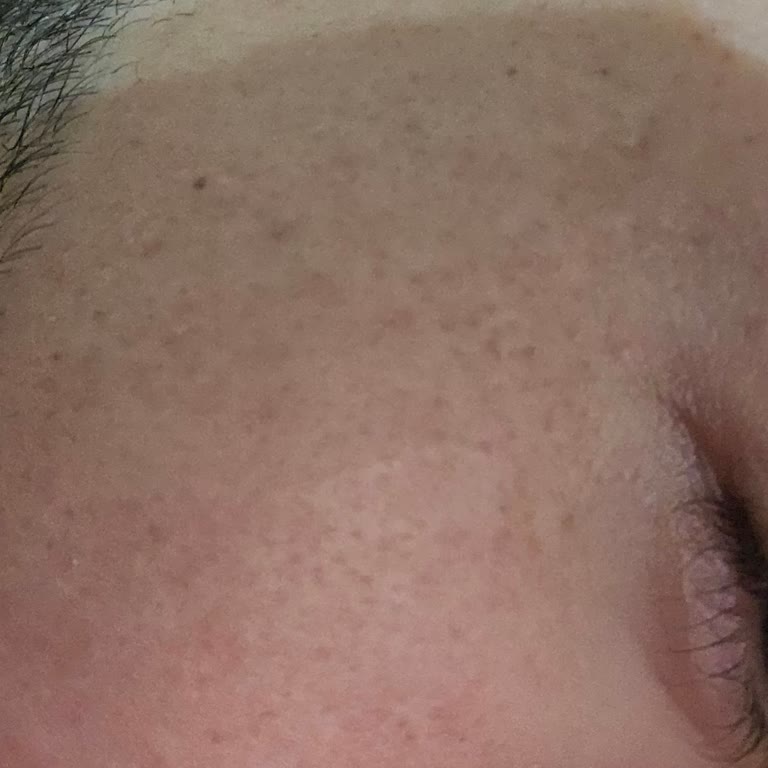 Fiyatı Çifte Çıktı, Sözleri Gerçekleşmedi Ve Ciltte İz Bıraktı