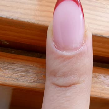 Protez Tırnak İşleminde Hava Alması Ve Ücret İadesi Talebi