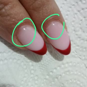 Protez Tırnak İşleminde Hava Alması Ve Ücret İadesi Talebi