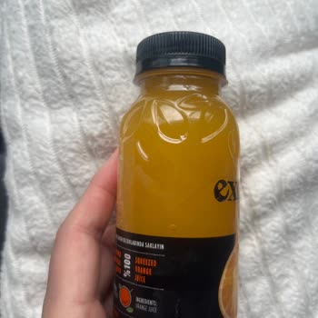 Migros Exotic Portakal Suyunda Saç Görülmesi Ve Hijyen Sorunu