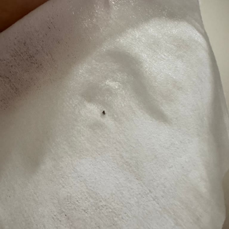 Molfix Yenidoğan Islak Mendil Ürününde Küf Sorunu