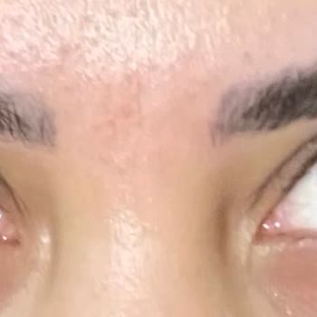 Ruşen Acar Güzellik Merkezi Kirpik Lifting İşlemi Başarısız, Ücret İadesi Reddedildi