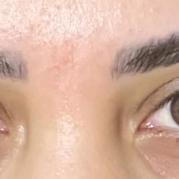 Ruşen Acar Güzellik Merkezi Kirpik Lifting İşlemi Başarısız, Ücret İadesi Reddedildi