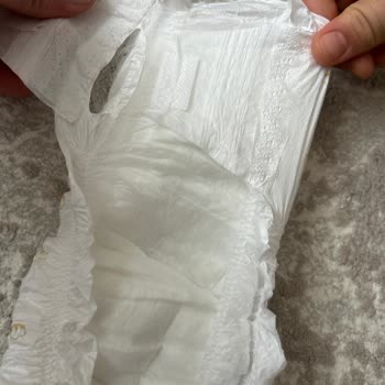 Hatalı Bebek Bezleri Yüzünden Sağlık Endişesi Ve İade Talebi