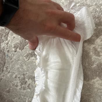 Hatalı Bebek Bezleri Yüzünden Sağlık Endişesi Ve İade Talebi