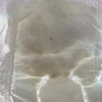 Molfix Bebek Bezinde İç Kısımda Kahverengi Lekeler Görüldü