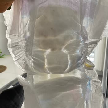 Molfix Bebek Bezinde İç Kısımda Kahverengi Lekeler Görüldü