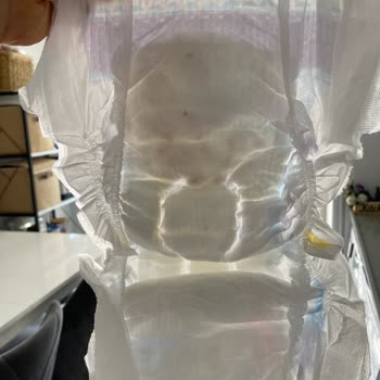 Molfix Bebek Bezinde İç Kısımda Kahverengi Lekeler Görüldü