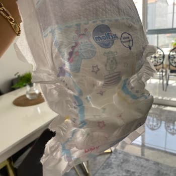 Molfix Bebek Bezinde İç Kısımda Kahverengi Lekeler Görüldü