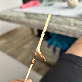 Kırık Dondurma Çubuğu Nedeniyle Ağız Yaralanması Ve Sağlık Riski