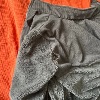 Kol Yırtığı Ve Müşteri Hizmetlerinden Yanıt Alamama: Ürün Değişimi Talebi