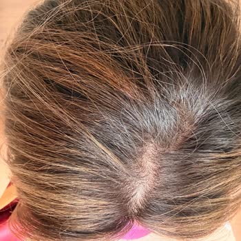 Saç Rengi Felaketi Ve Haksız 17 Bin Liraya Mağduriyet