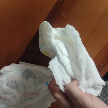 Molfix Bezlerde Üretim Hatası Ve Yırtılma Sorunu