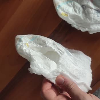 Molfix Bezlerde Üretim Hatası Ve Yırtılma Sorunu