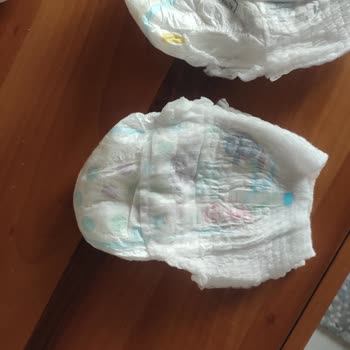 Molfix Bezlerde Üretim Hatası Ve Yırtılma Sorunu