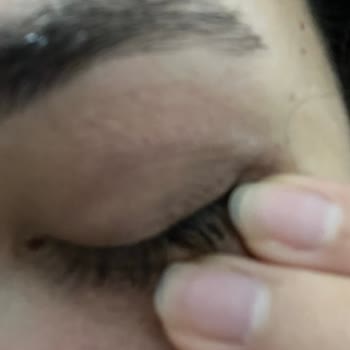 Yves Rocher Yüz Yıkama Jelinde Şiddetli Cilt Kuruluğu Ve Egzama Nedeniyle İade Talebi