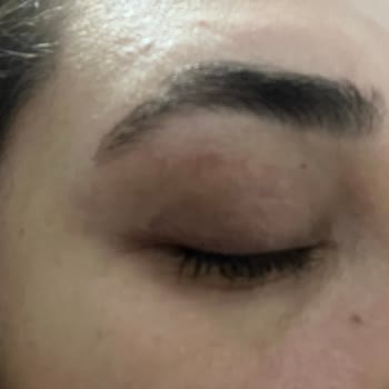 Yves Rocher Yüz Yıkama Jelinde Şiddetli Cilt Kuruluğu Ve Egzama Nedeniyle İade Talebi