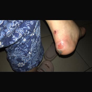 Vans Ayakkabısının Sert Topukları Nedeniyle Yaralanma Ve İade Şikayeti