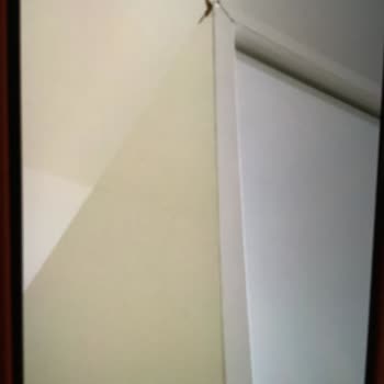 Gardırop Deformasyonu Ve Servis İlgisizliği