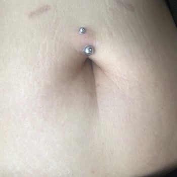 Hatalı Ve Steril Olmayan Piercing İşlemleri: Sağlık Endişesi Ve İade Talebi