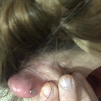Hatalı Ve Steril Olmayan Piercing İşlemleri: Sağlık Endişesi Ve İade Talebi