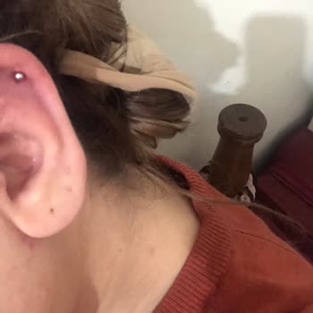 Hatalı Ve Steril Olmayan Piercing İşlemleri: Sağlık Endişesi Ve İade Talebi