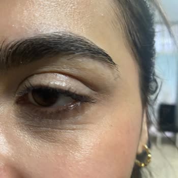 Botoks İşlemi Sonrası Şiddetli Şişlik Ve Cevapsızlık Nedeniyle Mağduriyet