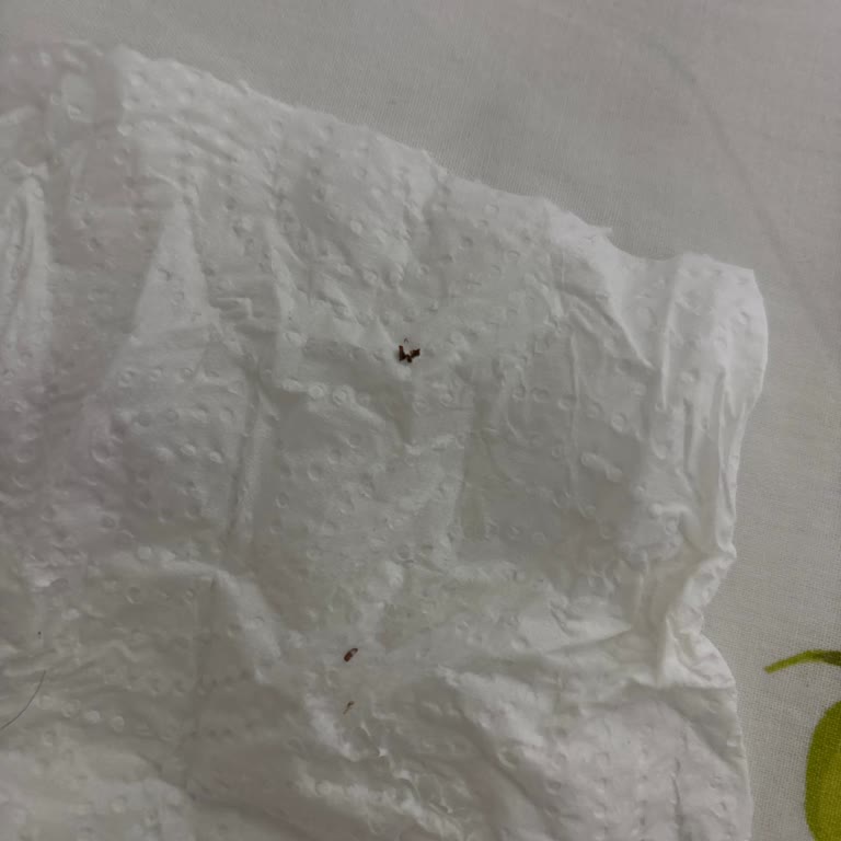 Yeni Açılmış Nivea Kreminin İçinde Karınca Bulunması