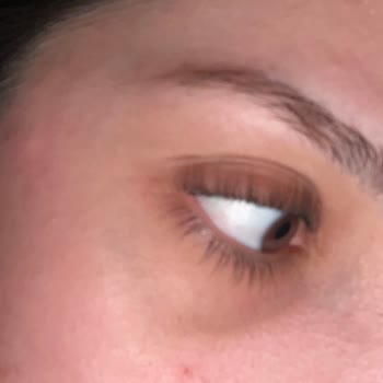 Kirpik Lifting İşleminde Göz Kapaklarına Aşırı Yapışma Ve Doğal Görünümün Bozulması