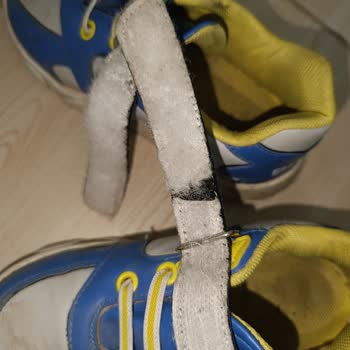 FLO Çocuk Ayakkabısı Üç Ayda Yıprandı, Tüketici Hatası Reddi