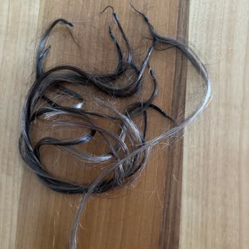 27.000 TL'lik Kaynak Saç İşlemi Sonrası Şiddetli Dökülme Ve Saygısız Yaklaşım