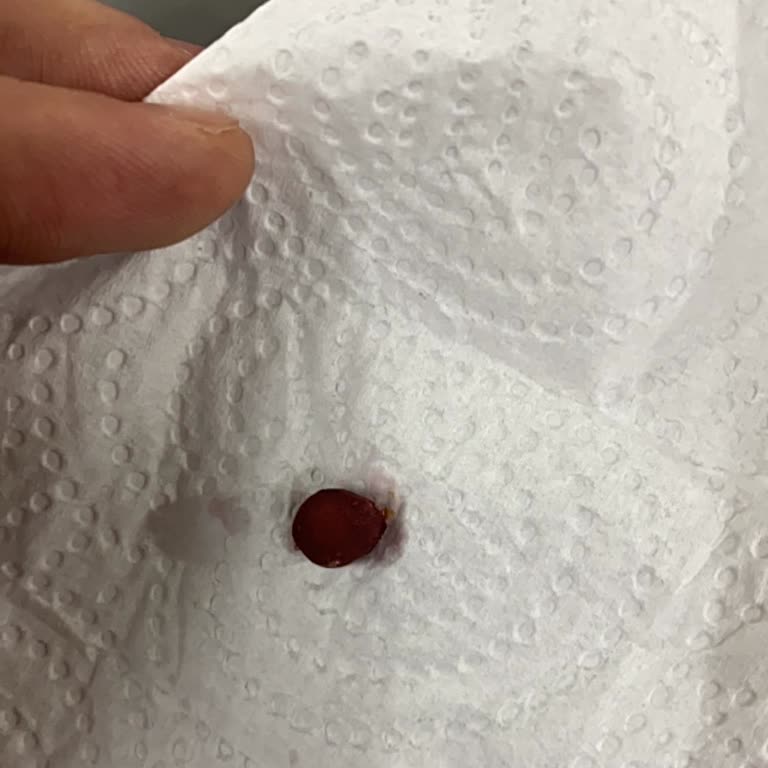 Tamek Vişne Reçelinde Çekirdek Bulunması Sağlık Güvenliğini Tehlikeye Attı