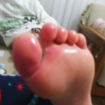 Skechers Su Geçirmez Ayakkabı Ayak Sağlığını Mahvediyor Ve İade Talebi