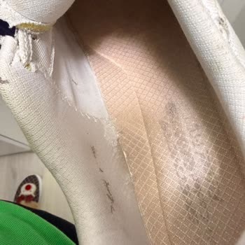 4000 TL'lik Skechers Ayakkabım Kısa Sürede Deforme Olup Ayağımı Yarıyor