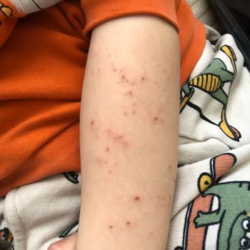 Fakir Range Multi Mist Sıcak Buhar Vermiyor, İade Talebim Reddedildi