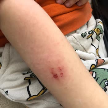 Fakir Range Multi Mist Sıcak Buhar Vermiyor, İade Talebim Reddedildi