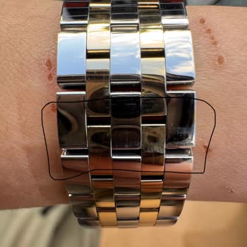 Yetkili Mağazada Saat Kordonunda Çizik Oluşması Ve Sorumluluk Reddi