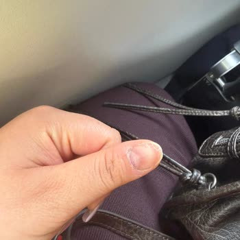 Tırnak Perisi (Ümraniye) Bir Hafta Bile Geçmeden 5 Tırnağım Çıktı ve Kırıldı