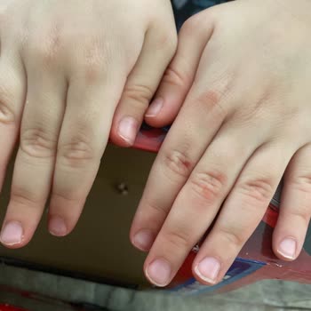 Mack Transforming Play Set’te Yoğun Boya Sızıntısı Çocuk Güvenliğini Tehdit Ediyor