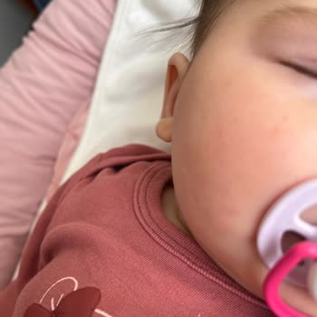 Bebekte Alerjik Dermatit: Mustela Ürünlerinden Geri Ödeme ve Açıklama Talebi