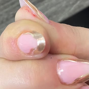 Sun Nail Bar Parmağımdan Sarı Sıvı Akmaya Başladı İltihap Topladı