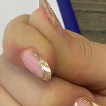 Sun Nail Bar Parmağımdan Sarı Sıvı Akmaya Başladı İltihap Topladı