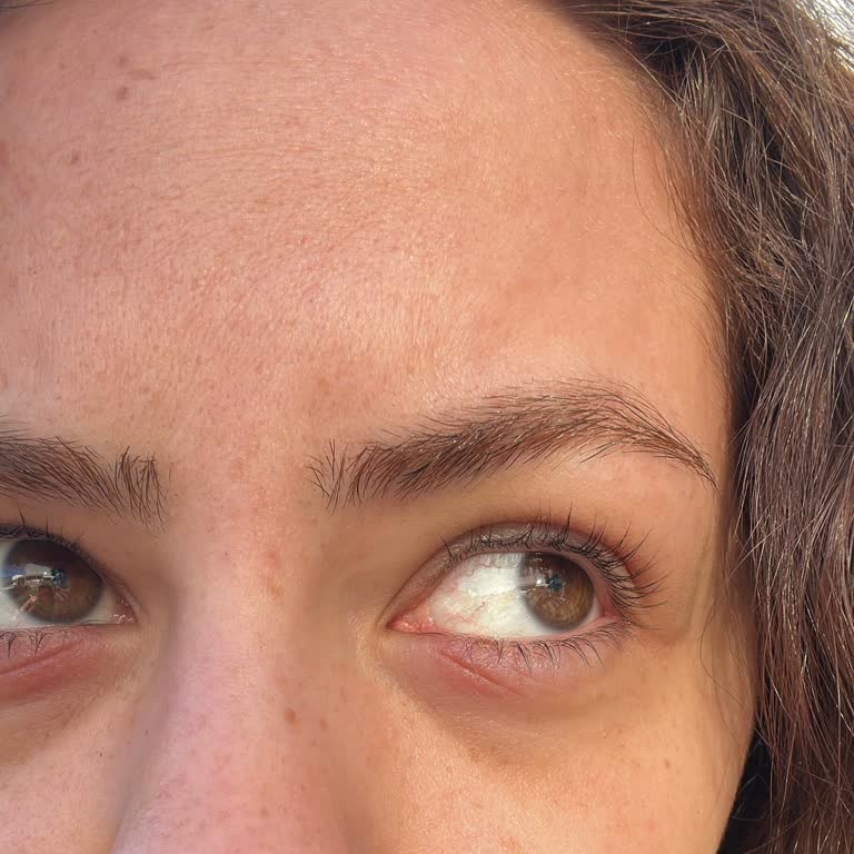 Estée Lauder Göz Kreminde Yanma, Tahriş Ve Akıntı Nedeniyle İade Talebi